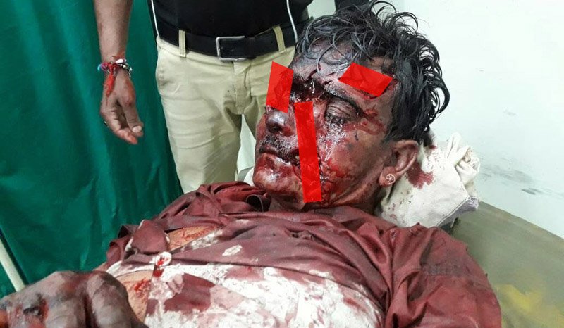 अचलगढ़, माउंट आबू में भालुओ का आतंक जारी, दिन दहाड़े 4 भालुओ ने एक आदमी को किया लहू लुहान