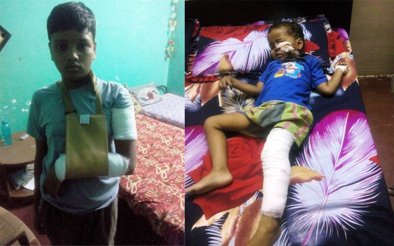 बंदर के हमले से दो मासूम घायल, आबूरोड में यह दूसरी घटना